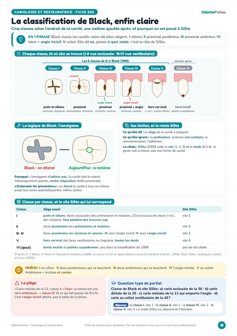 Fiche « La classification de Black, enfin claire » d’OdontoFiches